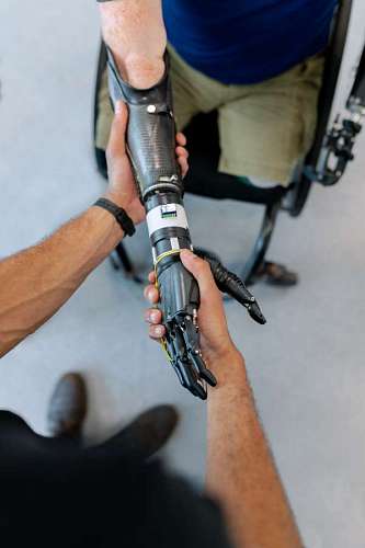 Man with prosthetic arm shaking hands