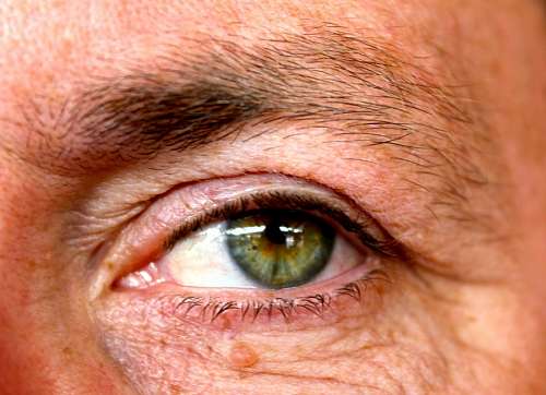 Green eye