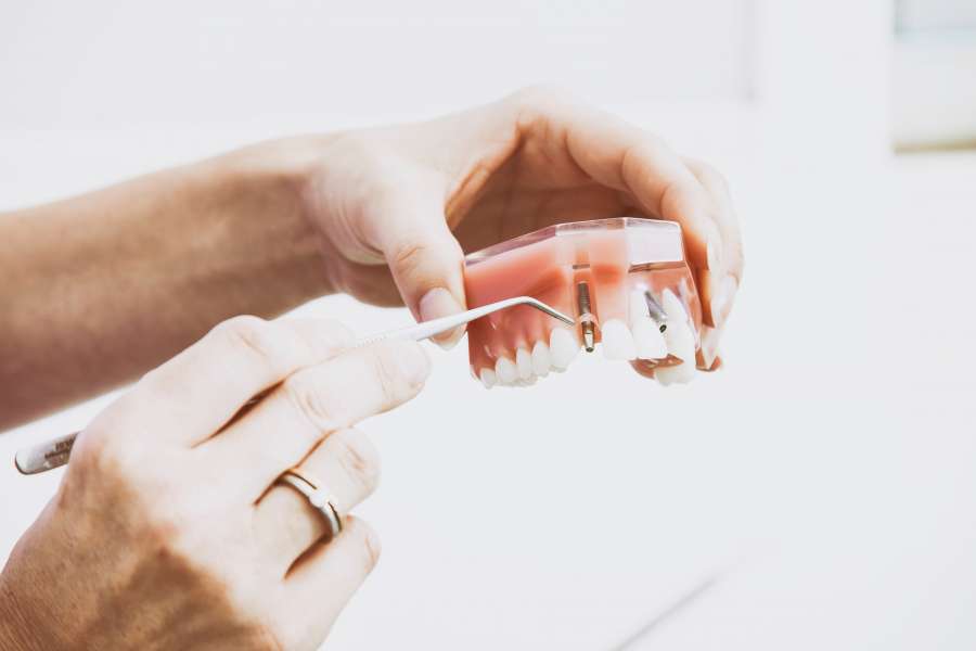 Dental Mechanic, Dentist, Prosthesis, Job, Profession, Denture, Bolt,
