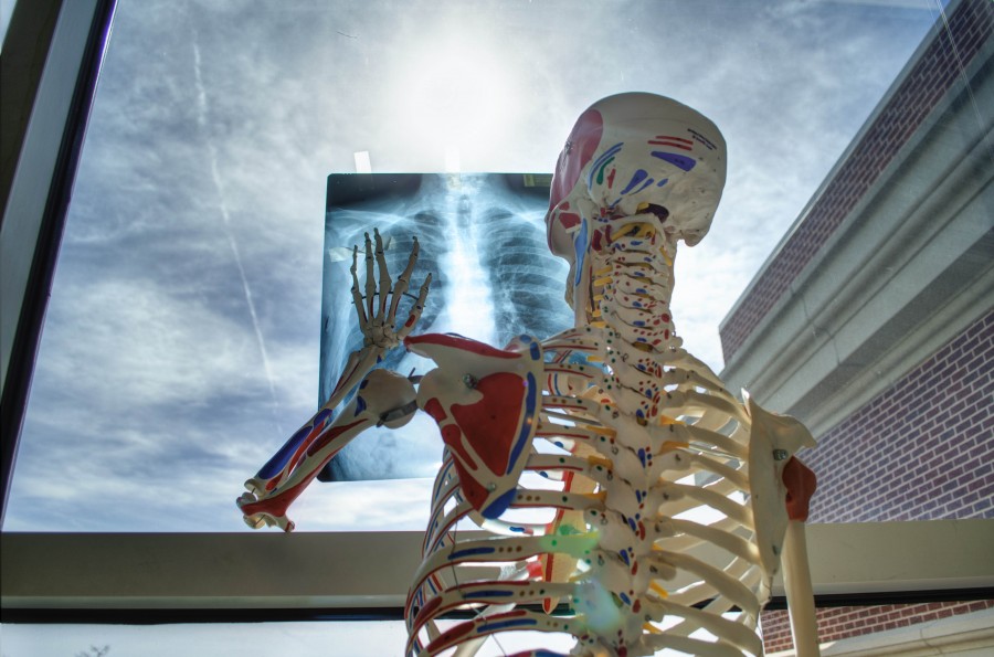 radiography, skeleton, concept, medicine, health,
