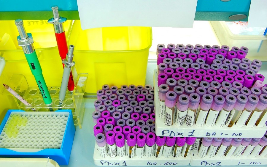 tube, tubes, test, laboratory, science, chemistry, medicine, interior, vaccine, vaccines, antibiotic, health,