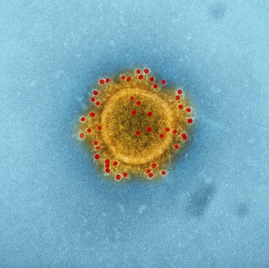 virus, macro, disease, science, biology, image, flu, microbiology, transmission, contagion,
